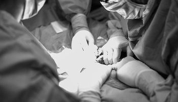 C-section birth photo